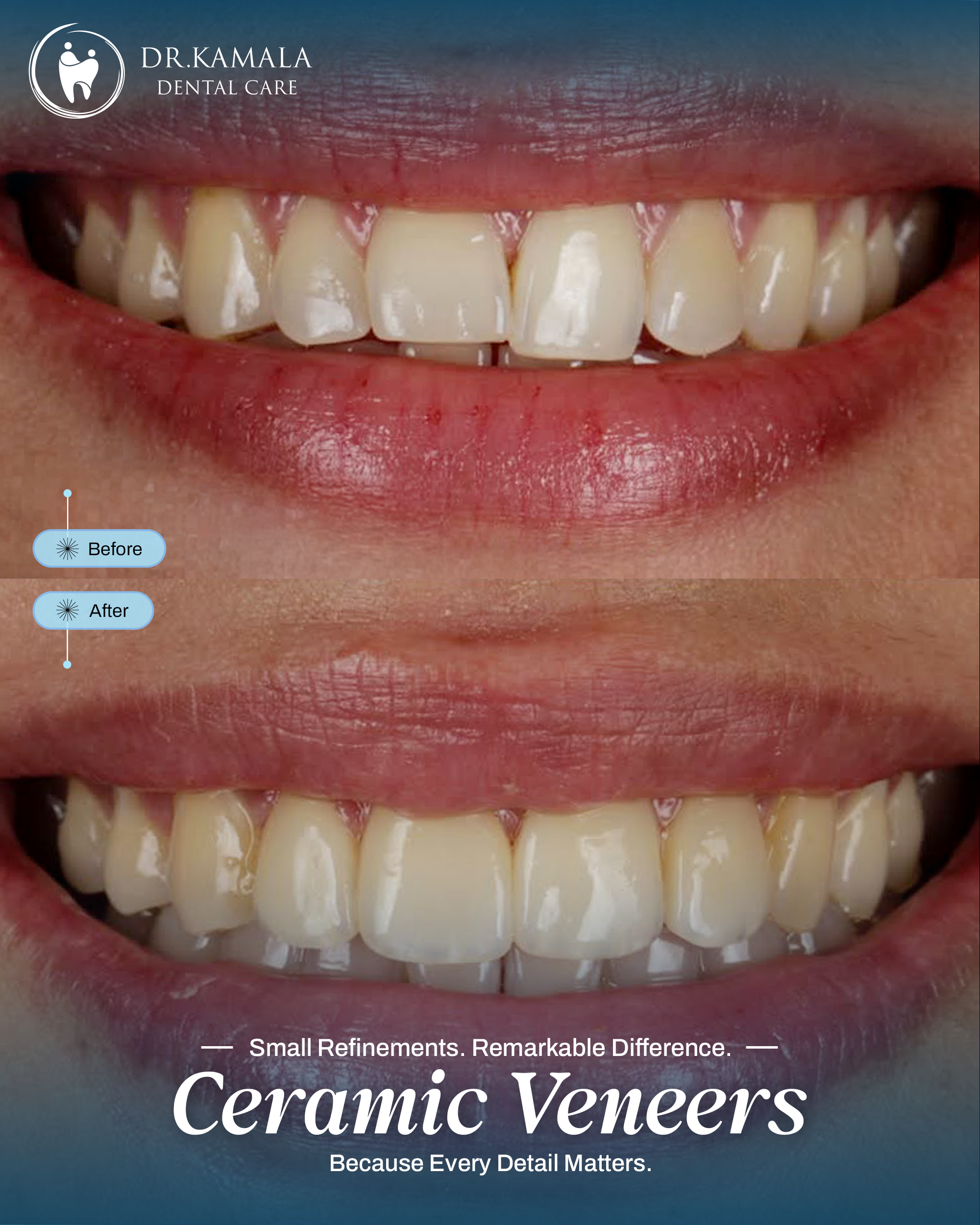 01 - KAMALA DENTAL - BEFORE AFTER (2)
