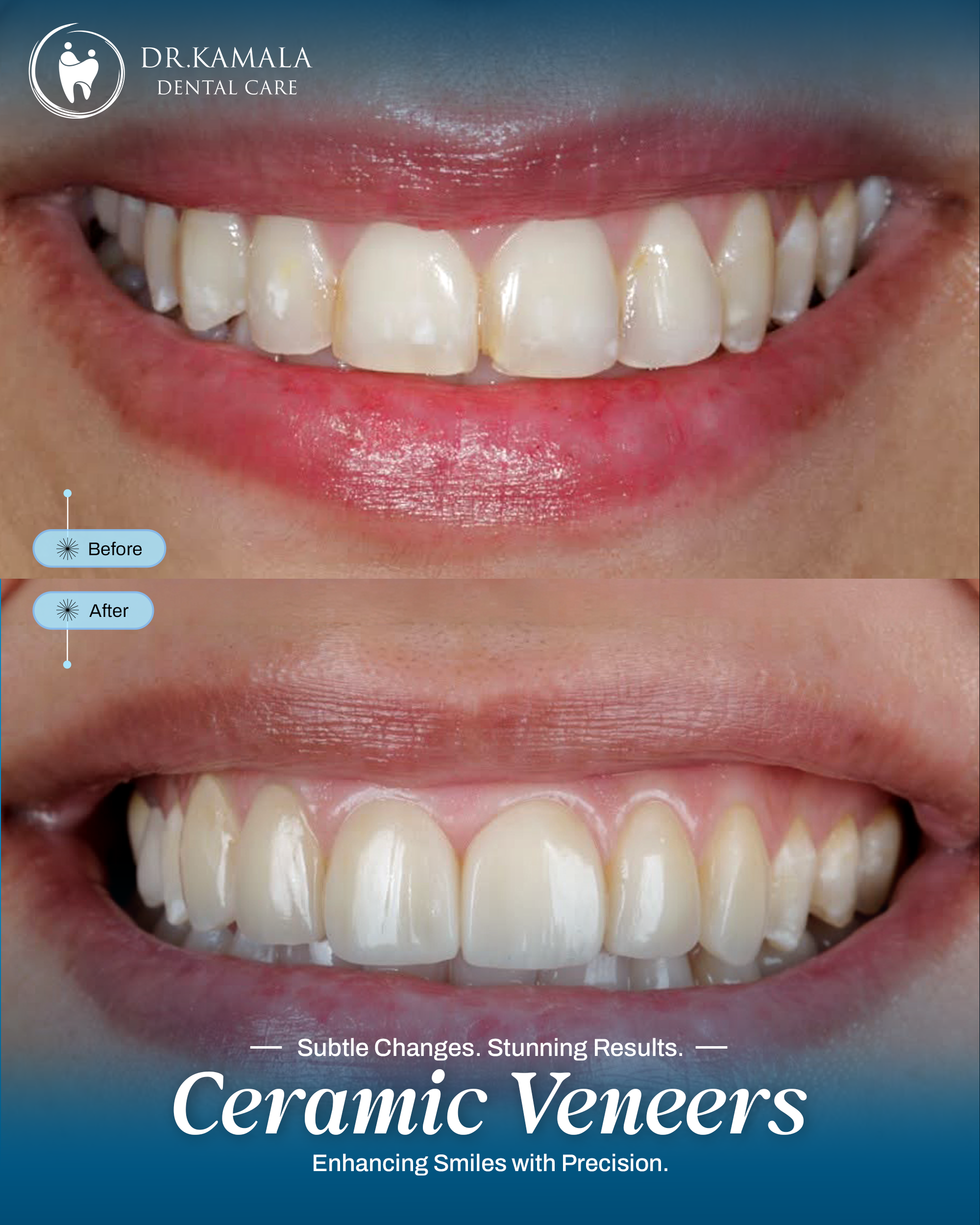 02 - KAMALA DENTAL - BEFORE AFTER (2)