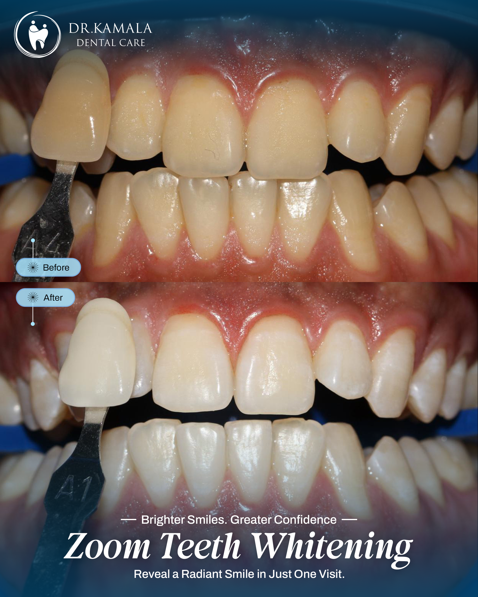 06 - KAMALA DENTAL - BEFORE AFTER (3)
