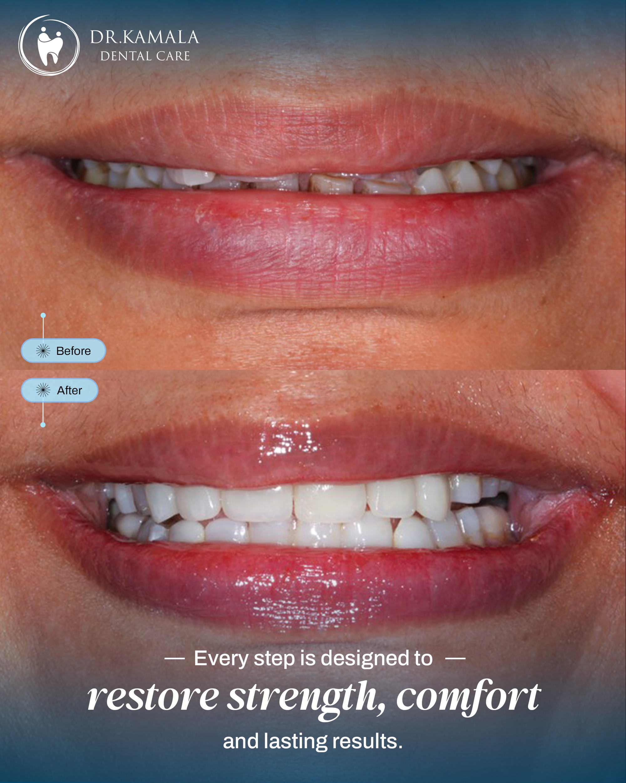 09 - KAMALA DENTAL - BEFORE AFTER
